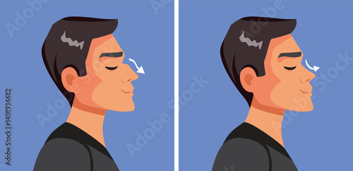 Man Gets Nose Surgery Vector Cartoon Illustration. Guy resorts to cosmetic procedures and also corrects his deviated septum 