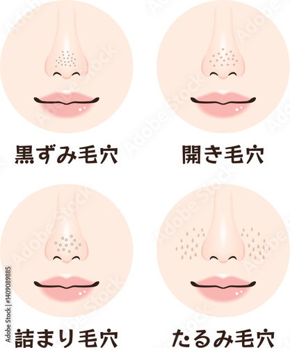 鼻の毛穴トラブル4種類セット｜黒ずみ・開き・詰まり・たるみ毛穴の鼻アップ素材