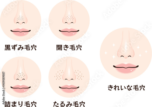 鼻の毛穴トラブル4種類セット｜黒ずみ・開き・詰まり・たるみ毛穴の鼻アップ素材