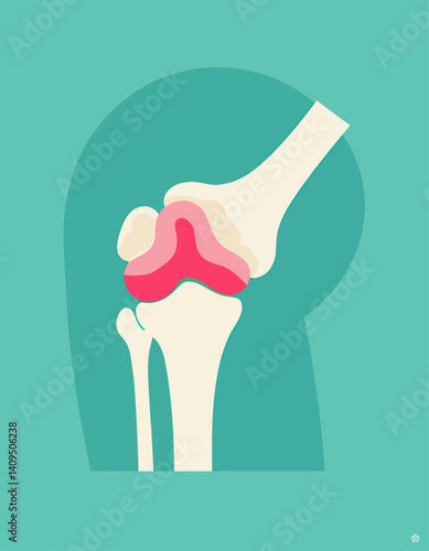 Knee joint anatomy, pink and white on teal background
