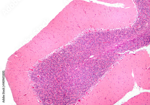 Human cerebellar cortex, photomicrograph showing Purkinje cells, granular cells, and molecular layer involved in motor coordination and balance.