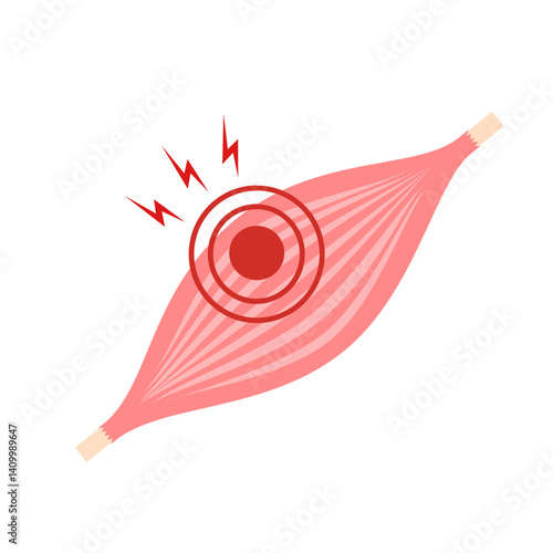 Calf Pain leg back muscle blood vessels nerve acute sport damage arterial trauma tennis soccer tear Cramp spasm Charley horses medial fiber bruising run walk tendon Clot deep vein pull torn up sprain