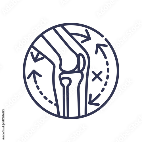 Illustration of a knee joint with arrows indicating movement restriction.