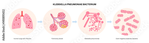 Klebsiella pneumoniae poster