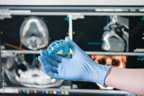 Orthodontic hand hold blue silicon mouth guard.