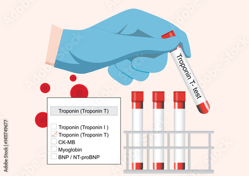 Troponin T is a cardiac biomarker used to detect heart muscle injury.