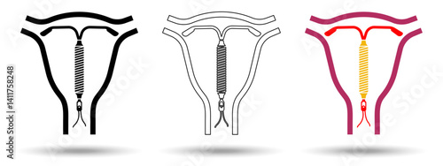 IUD icon. IUD icon on a white background, isolated. The icon has three uses in applications and websites. Vector illustration. IUD icon on a white background.