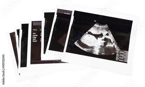 積み重なったエコー写真, 切り抜き