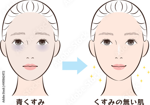 青くすみ肌からくすみの無い肌へのビフォーアフター