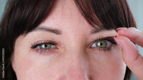 The woman has a drooping eyelid