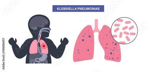 Klebsiella pneumoniae poster