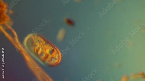 Frontonia sp. ciliated protist water microbe-200x DIC