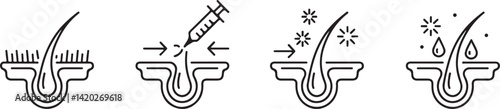 Hair Growth Cycle Stages Illustration  Follicle, Injection, and Hydration