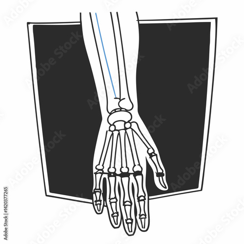 Transparent arm showing bones, nerves, and mechanical enhancements