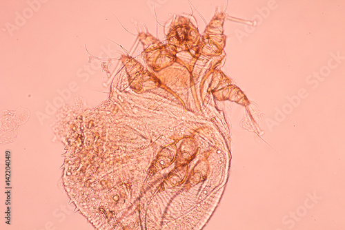 Tableau sur toile Image of pubic lice in microscopy from urine specimen