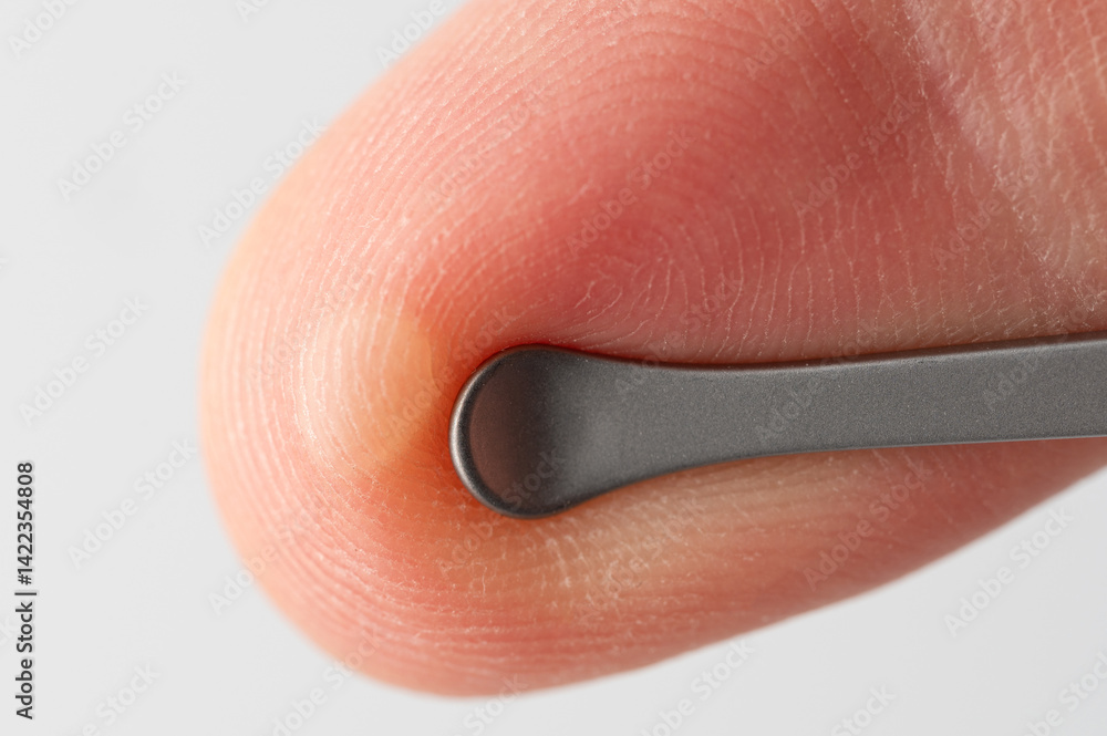 Blister bubble on finger