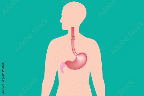 Healthcare infographic depicting esophageal cancer symptoms and anatomy. green background