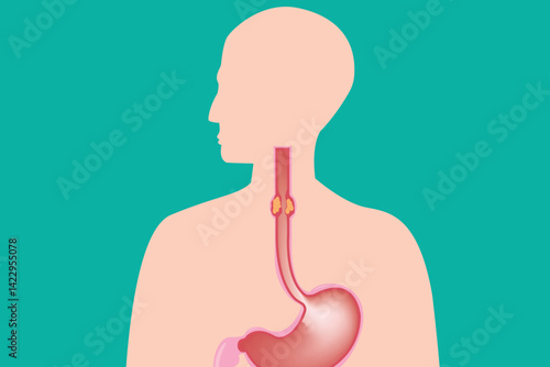 human silhouette. medical illustration of esophageal cancer. eps 10