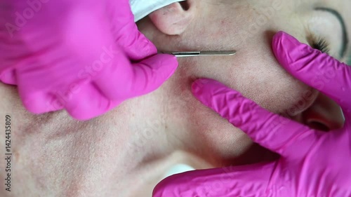 Dermaplaning facial close-up horizontal — A professional cosmetologist gently exfoliates dead skin cells using a sterile scalpel. Horizontal video, macro detail, smooth skin results, skincare procedur
