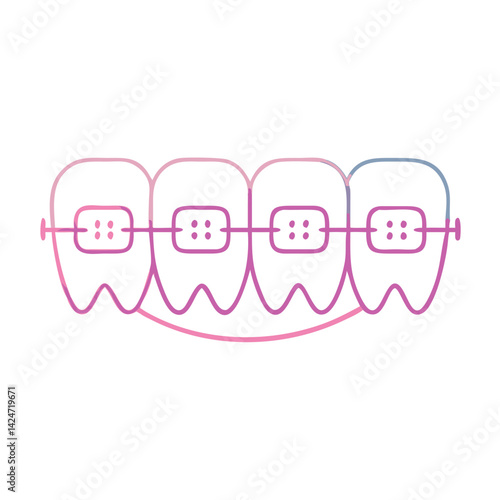 Colorful dental braces outline on teeth for correction