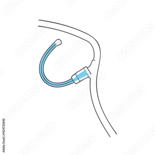 Peritoneal dialysis catheter vector illustration on a black background
