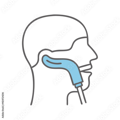 Nasogastric tube placement illustration in head schematic view