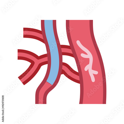Human Blood Vessels and Vascular System Medical Illustration