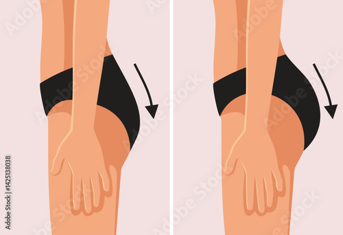 Buttock Augmentation Surgery Before and After Vector Illustration. Results of the transformation after a cosmetic procedure called bbl 
