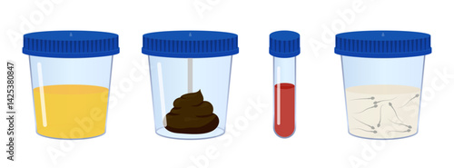 Medical analysis containing urine, feces, blood and sperm samples