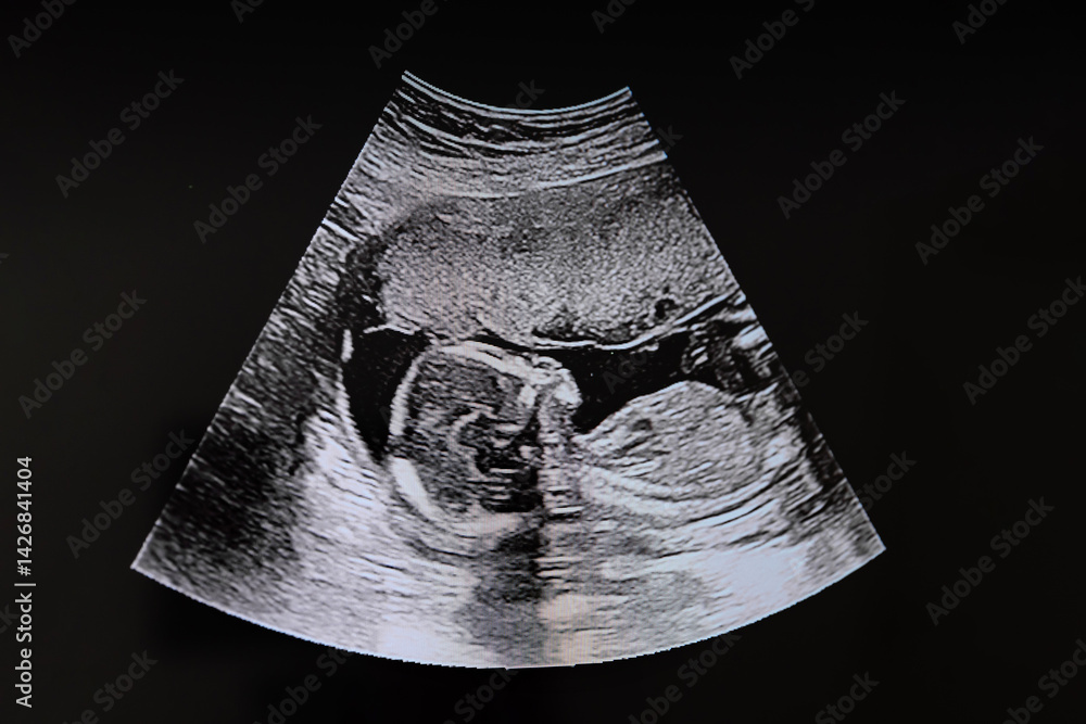 An ultrasound of a human fetus during the 16th week. Ultrasound of a child baby in the womb. Fetus development and pregnancy health checking. High quality photo