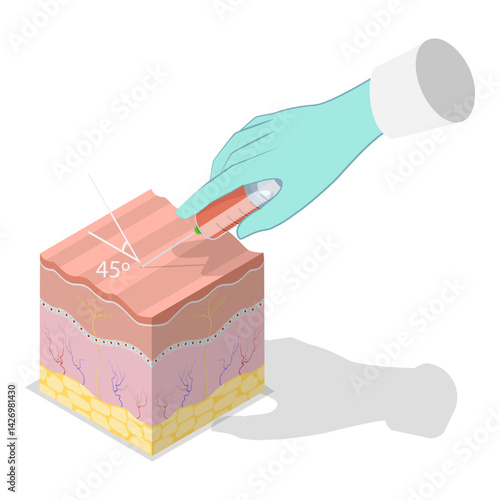 3D Isometric Flat Vector Illustration of Types Of Injections, Basic Medical Study. Item 1