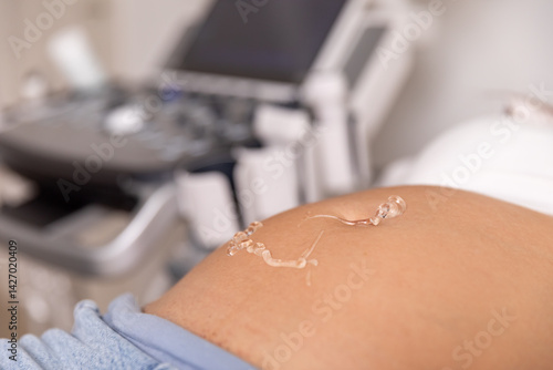Obraz na płótnie Gel on the abdomen of a pregnant woman for ultrasound medical examination in the clinic. Close up shot. High quality photo. w salonie
