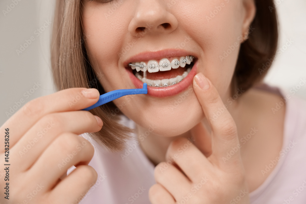 Young woman with dental braces cleaning teeth at home, closeup