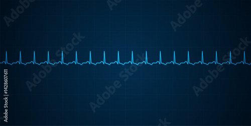 Emergency ekg monitoring. Blue glowing neon heart pulse. Heart beat. Electrocardiogram