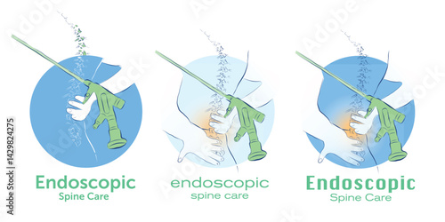 Vector Illustration of Endoscopic Spine Care Logo Design in Simple Line Art Style on White Background