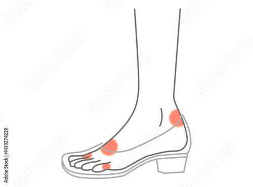 靴擦れしやすい箇所のイラスト