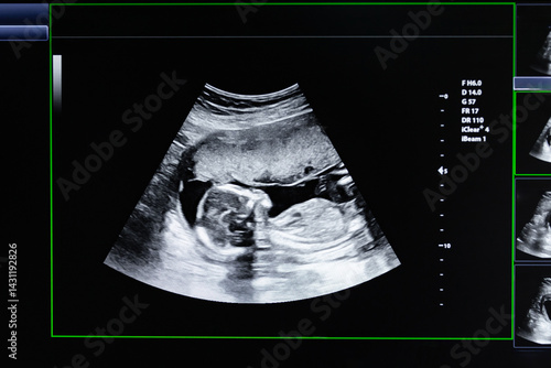 An ultrasound of a human fetus during the 16th week. Ultrasound of a child baby in the womb. Fetus development and pregnancy health checking. High quality photo