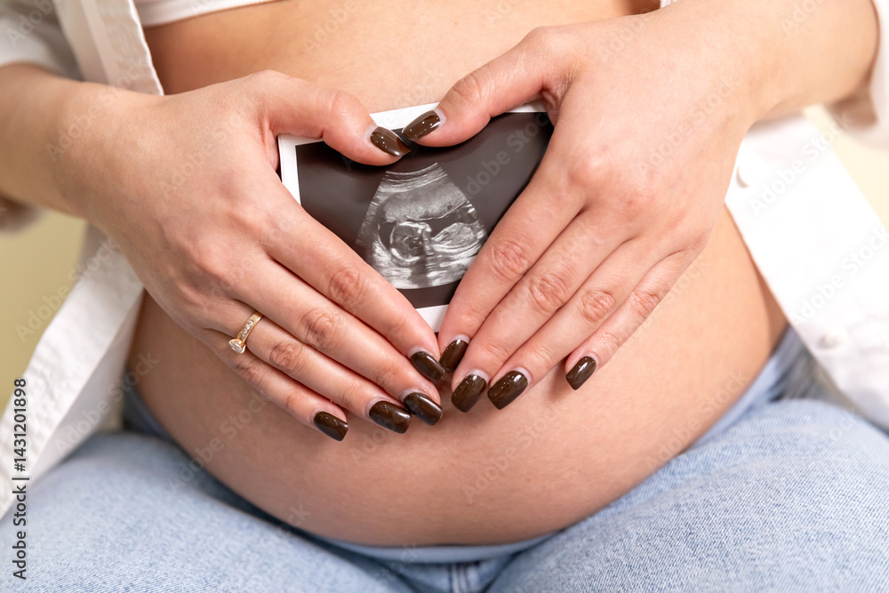 Pregnant woman holding an ultrasound image of the baby. Close-up of pregnant belly and ultrasound photography in mother's hands. Untied and healthy pregnancy concept