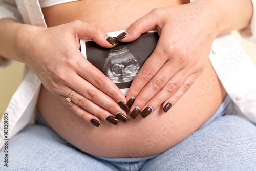Pregnant woman holding an ultrasound image of the baby. Close-up of pregnant belly and ultrasound photography in mother's hands. Untied and healthy pregnancy concept