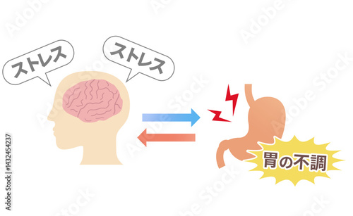 ストレスで胃が痛くなる仕組み、胃脳相関と機能性ディスペプシアの概念図。