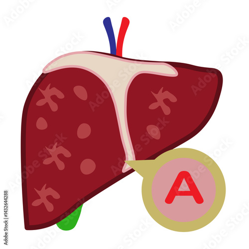 hepatitis a