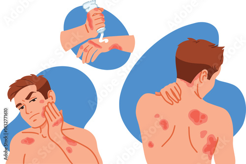 Stressed man with allergic itching, skin inflammation, redness and irritation. Upset guy suffer from itchiness and redness. Atopic dermatitis, eczema, psoriasis, dry skin. Skin diseases set. 