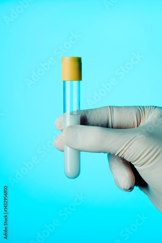 Obraz na płótnie healthcare worker with a test tube with some semen w salonie