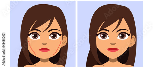 Cartoon illustration of a woman face showing before and after cosmetic facial surgery. Concept for reconstruction of cheek and jawline contouring, facial lifting and aesthetic enhancement