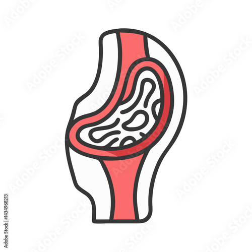Medical illustration showcasing the anatomy of an artificial joint