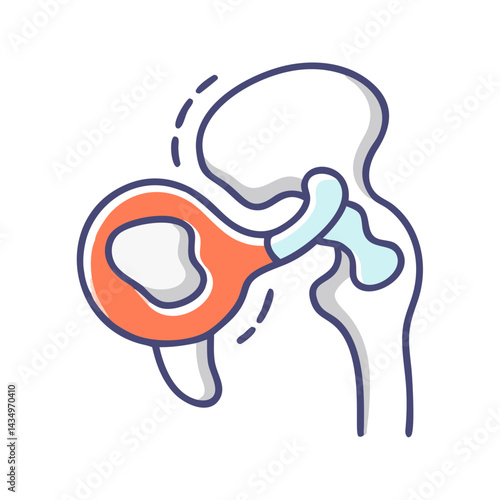 Hip dysplasia diagram illustration on black background in cartoon style