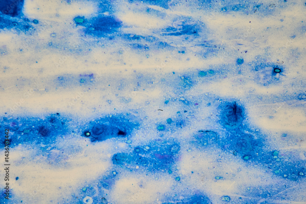 Microscopic image of the protozoan bacterium Cryptosporidium