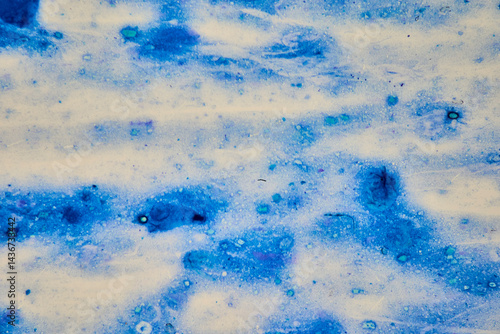 Obraz na płótnie Microscopic image of the protozoan bacterium Cryptosporidium w salonie