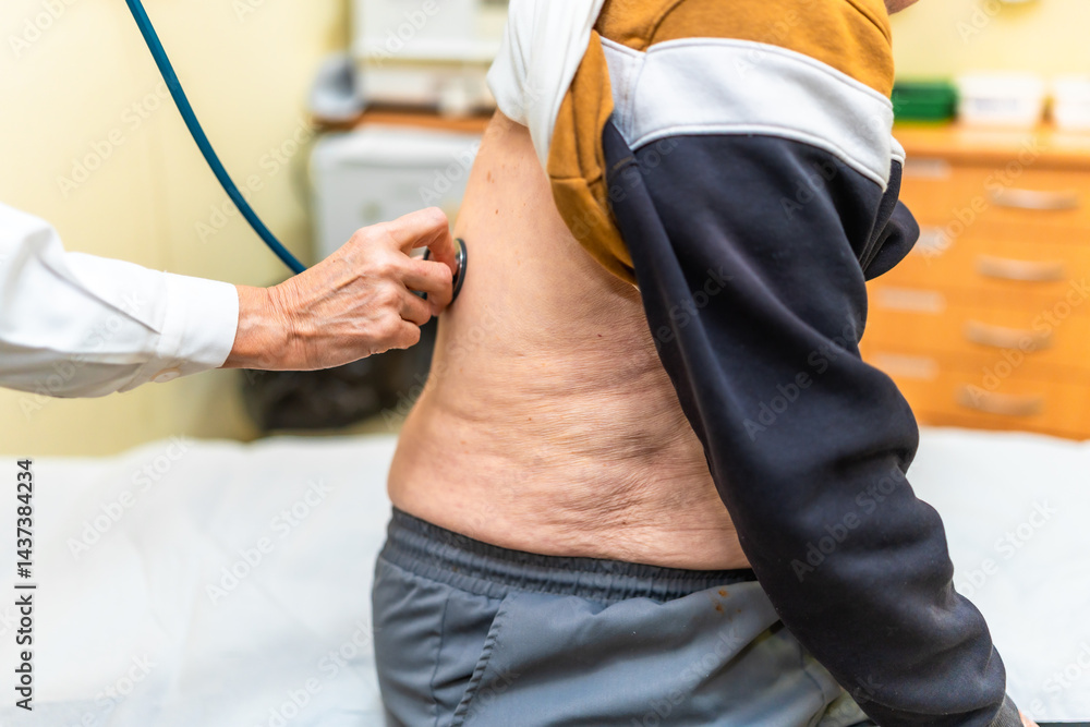 Doctor examining senior man lungs with stethoscope in nursing home