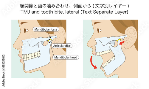 顎関節と歯の噛み合わせ、側面から TMJ and tooth bite, lateral (Text Separate Layer)
